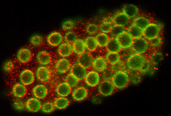 Figure 1: Programmed cell death in C. elegans...